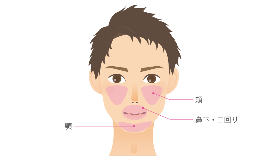 ひげの脱毛部位